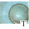 internal